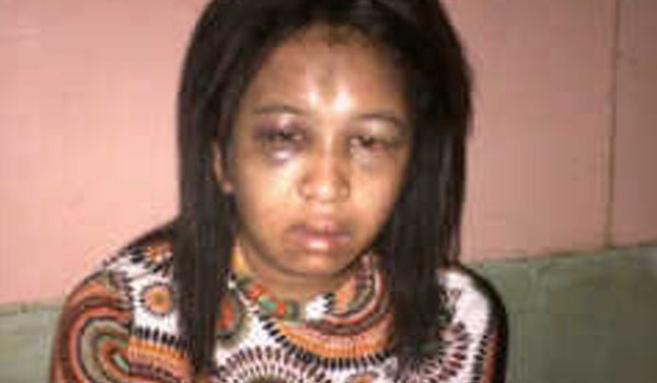 <b>Foto:</b> Rahmawati PRT Disiksa Majikan